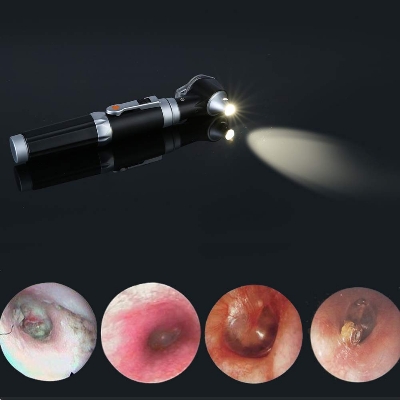 Picture of Mini Otoscope - Magnification Diagnostic Ear Scope With LED Direct Illumination Light, Health Tool for Doctors, Nurses, Adults, Kids, Baby, Elder, Pets, Animals