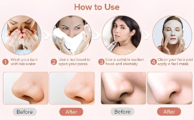 Picture of 6 In 1 Multi-Function Blackhead Remover Tool, USB Rechargeable Derma suction Machine, Pimple Removal Tool for Men and Women