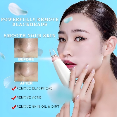 Picture of 6 In 1 Multi-Function Blackhead Remover Tool, USB Rechargeable Derma suction Machine, Pimple Removal Tool for Men and Women