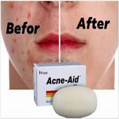 Picture of Stiefel Original Acne-Aid Bar 100g Pimple Prone & Oily Skin Acne Aid Soap