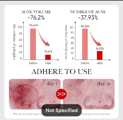 Picture of SADOER Fruit Acid AHA+BHA Acne Repair Serum-30ml - 