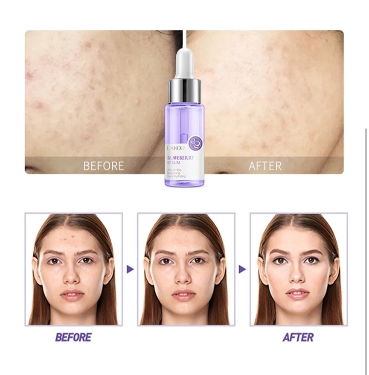 Picture of LAIKOU Anti-wrinkles Blueberry Serum- 17ml - Blueberry