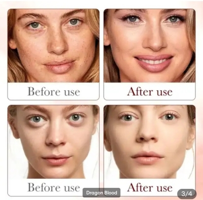 Picture of SADOER Dragon Blood Anti-Ageing Skin Care Serum-30ml - 