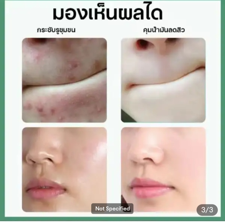 Picture of SADOER Clear Pores Chlorophyll Amino Acid Clarifying Cleans Mud- 100g - 