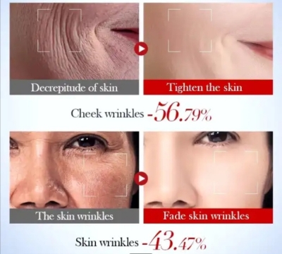 Picture of SADOER Snail Collagen Bosein Centella Asiatica Hyaluronic Acid Niacinamide Anti Wrinkle Serum- 50ml - 