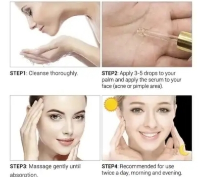 Picture of Breylee Acne Treatment Serum- 17ml - 