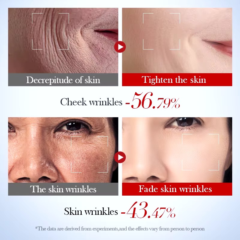 Picture of SADOER Snail Collagen Bosein Centella Asiatica Hyaluronic Acid Niacinamide Anti Wrinkle Serum- 50ml - 