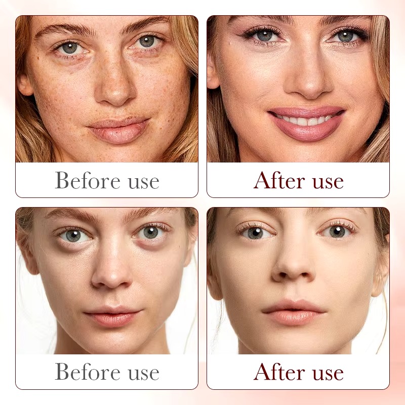 Picture of SADOER Dragon Blood Anti-Ageing Skin Care Serum- 30ml - 