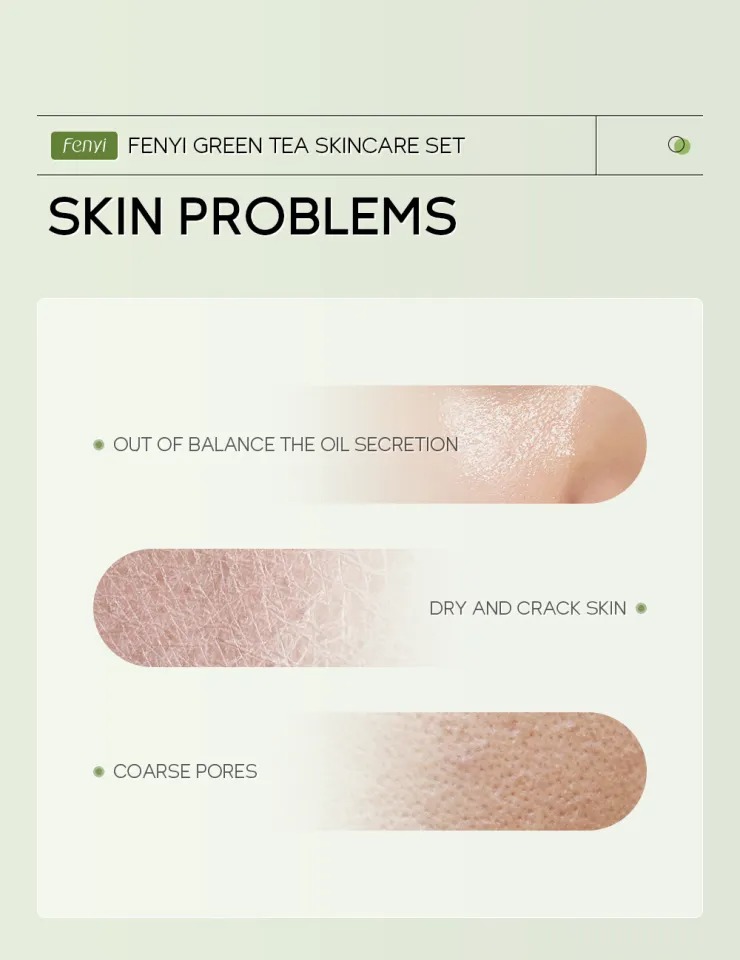 Picture of Fenyi Green Tea Extracted 6 pcs Skin Care Set - 