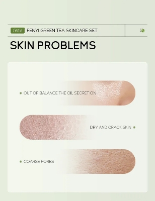 Picture of Fenyi Green Tea Extracted 6 pcs Skin Care Set - 