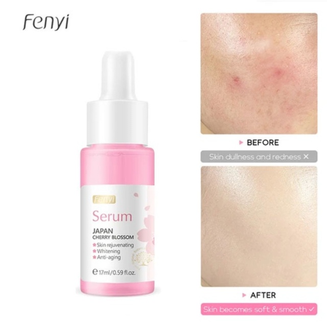 Picture of Fenyi Japan Cherry Clossom Skin Rejuvenating Face Sefrum- 17ml - 