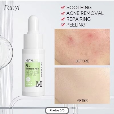 Picture of Fenyi 5% Mandelic Acid Anti Acne Serum- 17ml - 