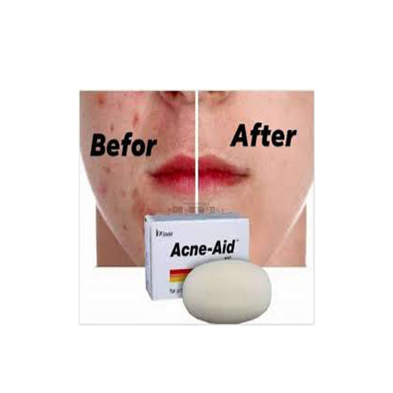 Picture of Stiefel Original Acne-Aid Bar 100g Pimple Prone & Oily Skin Acne Aid Soap