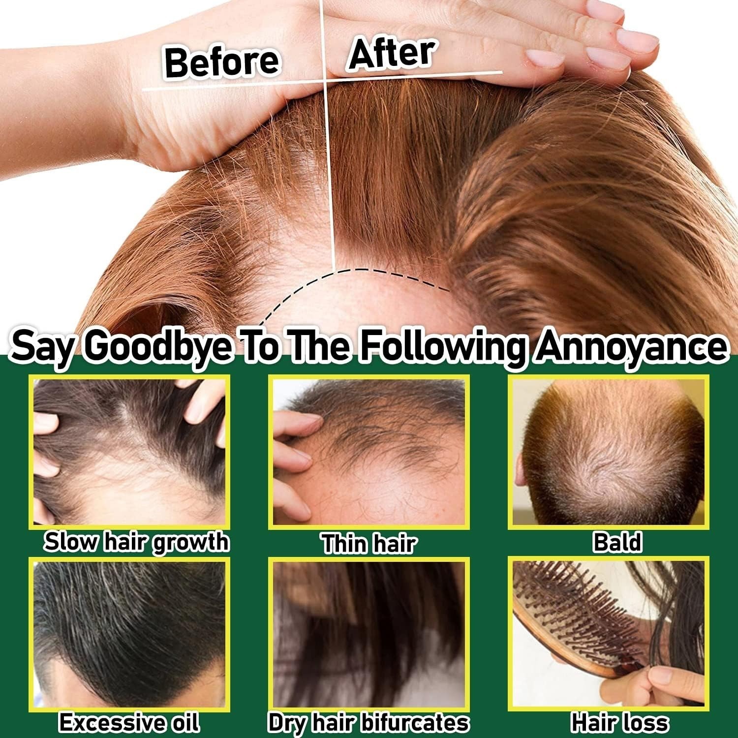 Picture of Organic Ginger Oil China Ginger Hair Growth Serum Sprayer Fast Hair Growth Dense Regrowth Ginger Serum Oil Natural Hair Growth Accelerator For Stronger