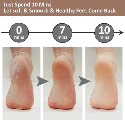 Picture of Rechargeable Pedi spin Finishing Touch Flawless Salon Nails Kit, Electronic Nail File and Full Manicure and Pedicure Tool