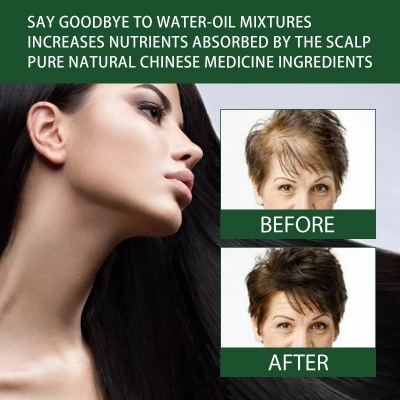 Picture of Ginger oil Hair (Oil) Growth Therapy Authentic and original 50ml