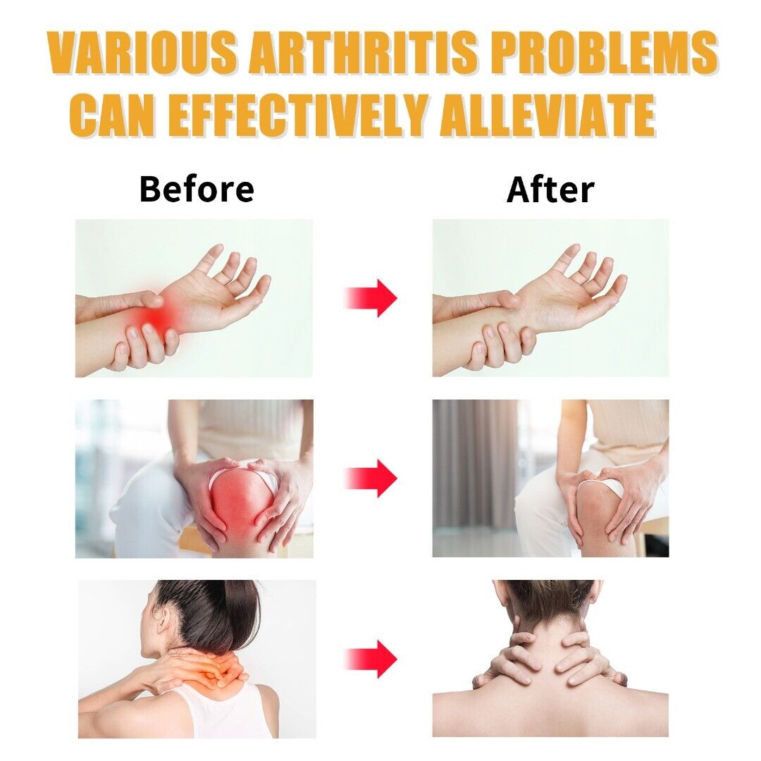 Picture of Joint Pain Relief Cream For Artharities