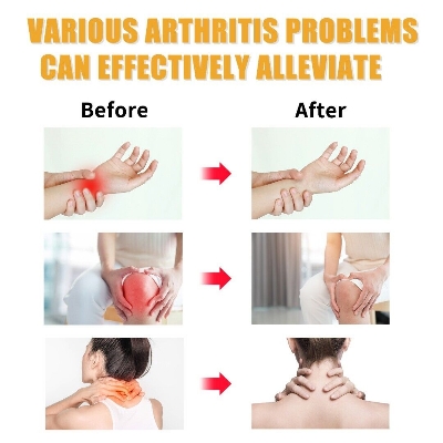 Picture of Joint Pain Relief Cream For Artharities