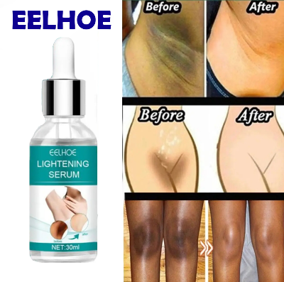Picture of Retinol EELHOE Dark Parts Dark Underarm and Bikini Areas Whitening Anti Wrinkle Moisturizing Makes Your Private area Clean And White