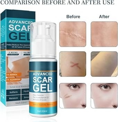 Picture of Jaysuing Advanced 50ml Scar Removal Gel - Effective Stretch Mark, Acnes Spots, Burns and Surgical Scars Treatment Cream Scar Gel No Side Effect