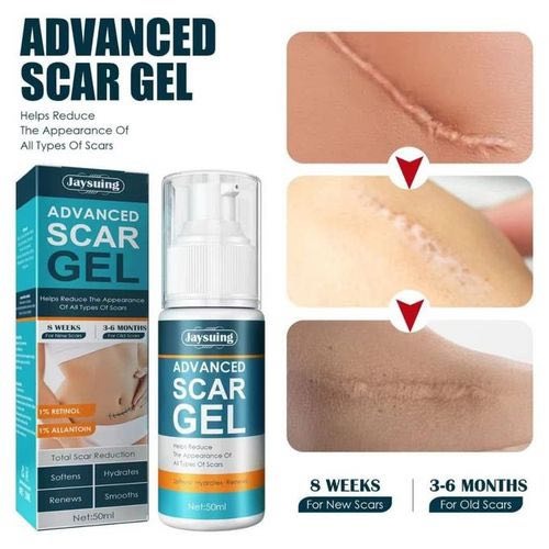 Picture of Jaysuing Advanced 50ml Scar Removal Gel - Effective Stretch Mark, Acnes Spots, Burns and Surgical Scars Treatment Cream Scar Gel No Side Effect