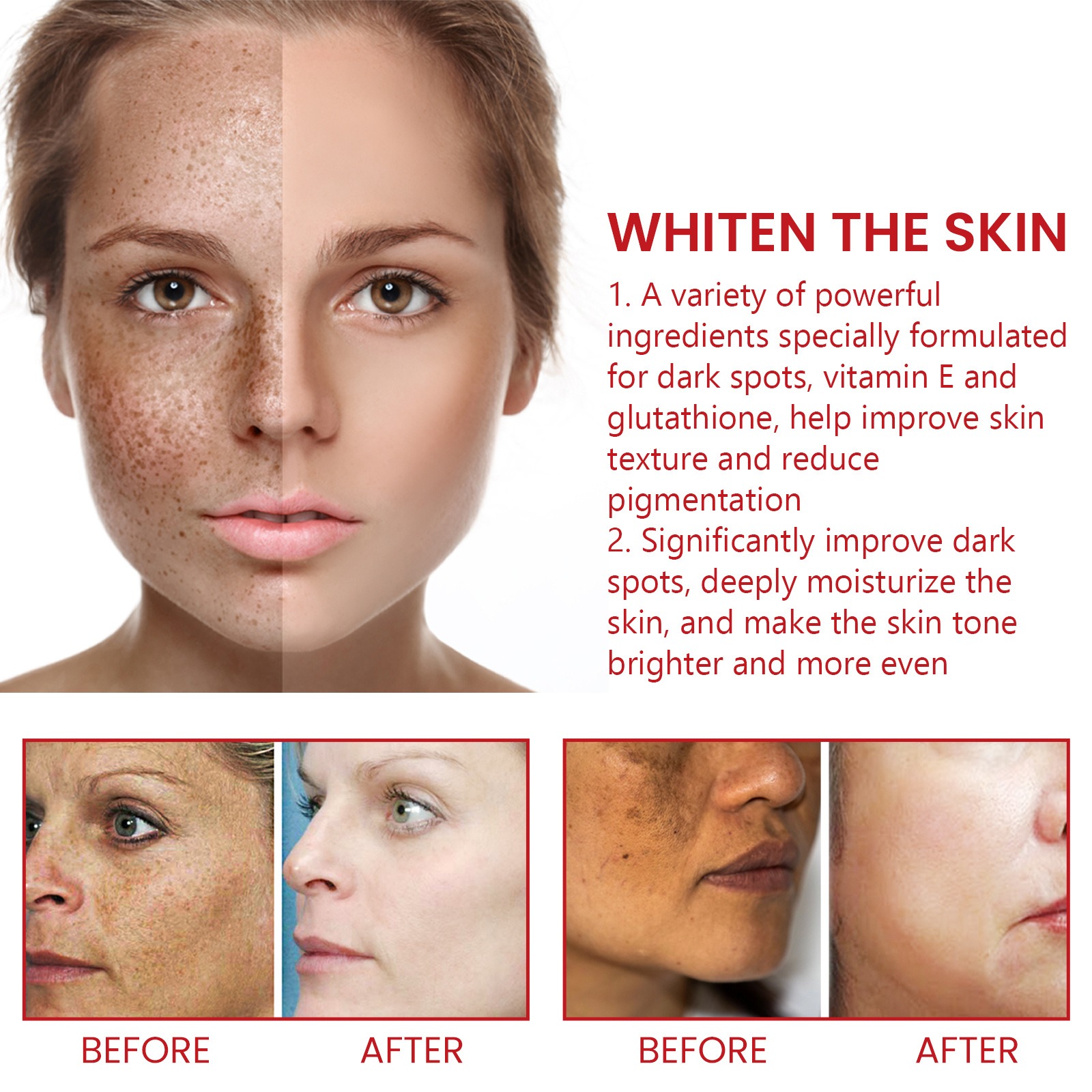 Picture of Dark Spot Remover For Face & Body Age Spot Brown Spot Sun Spot & Freckle Remover for Face Hands and Other Body Areas for Both Women and Men