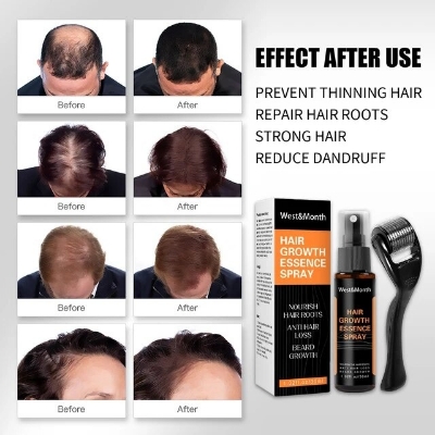 Picture of West&Month Hair Growth Essence Spray Hair Loss Product Hair Regrowth Spray Anti Preventing Hair Loss Essence We