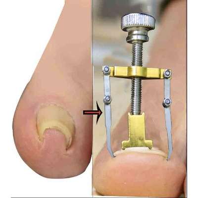 Picture of Nail care machine for nail repair