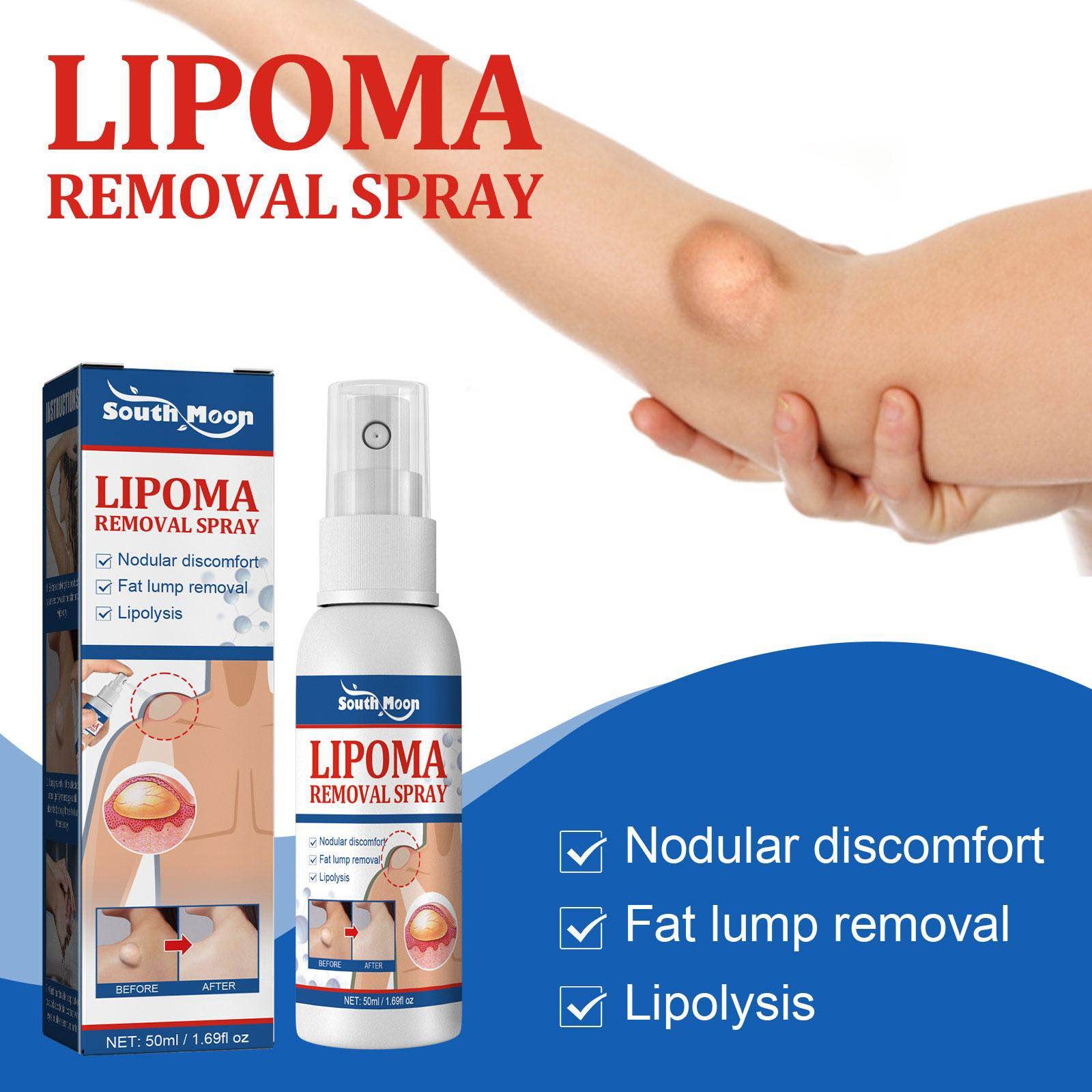 Picture of Lipomas Removal Spray Relief Pain Treat Skin Swelling Lipolysis 50ml Spray Cellulite Ointment Lump Fat Nodule Removal