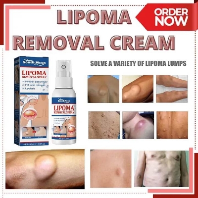 Picture of Lipomas Removal Spray Relief Pain Treat Skin Swelling Lipolysis 50ml Spray Cellulite Ointment Lump Fat Nodule Removal