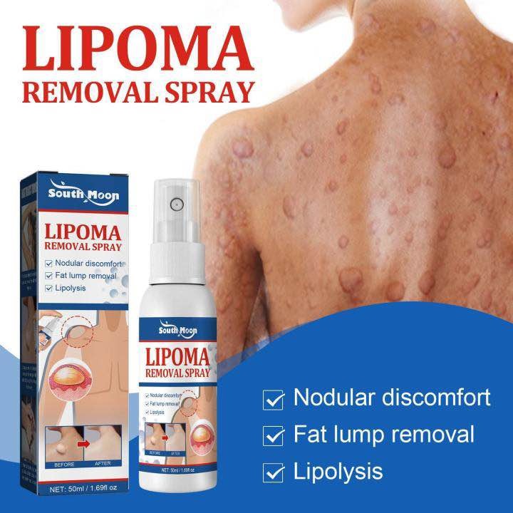 Picture of Lipomas Removal Spray Relief Pain Treat Skin Swelling Lipolysis 50ml Spray Cellulite Ointment Lump Fat Nodule Removal