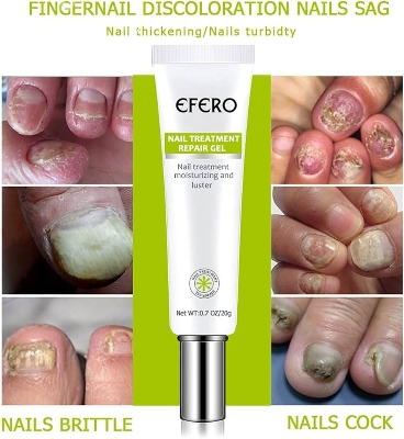 Picture of Efero Nail Repair Treatment Gel Fungus Cream-20gm