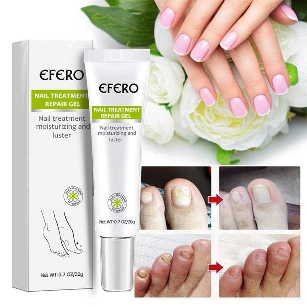 Picture of Efero Nail Repair Treatment Gel Fungus Cream-20gm