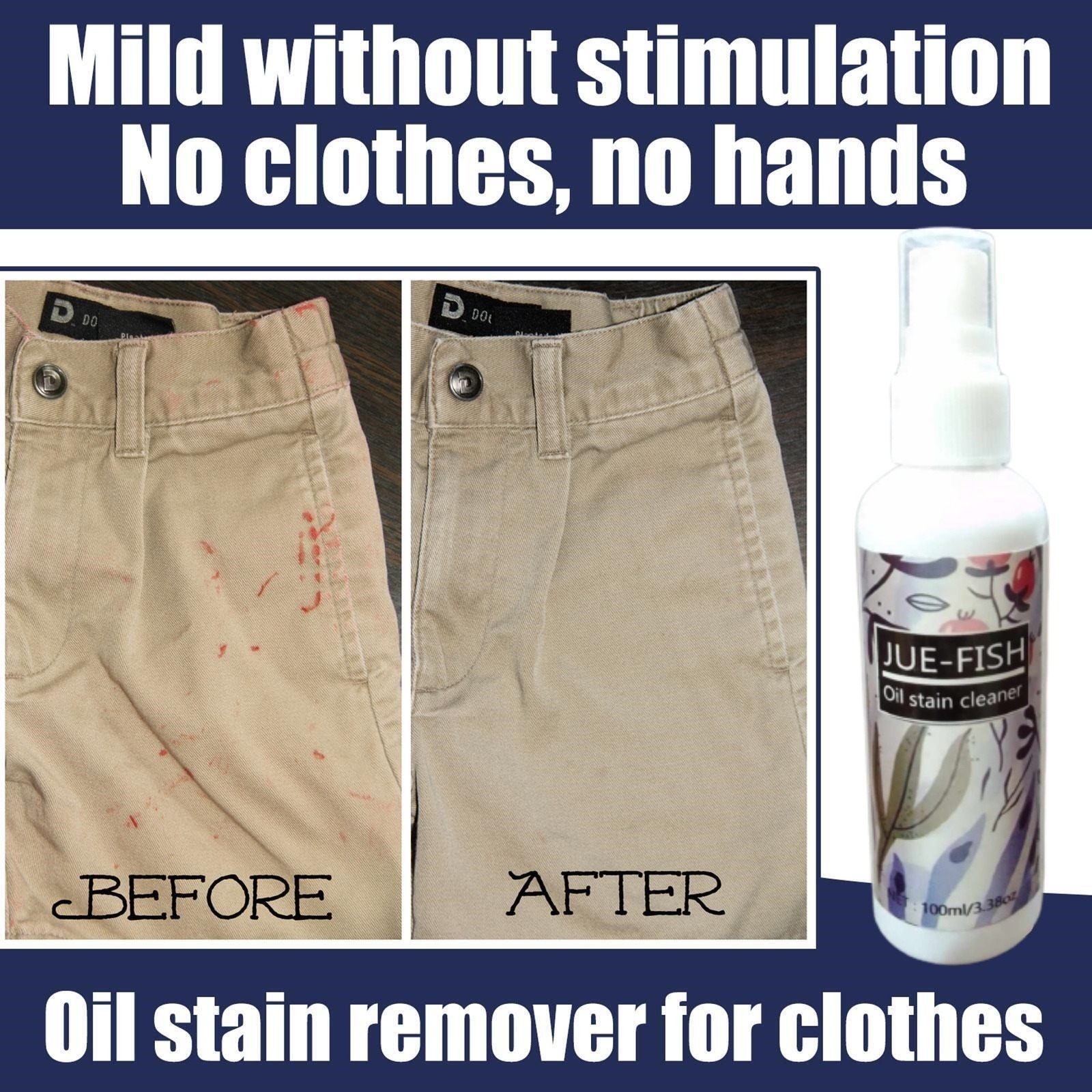 Picture of কাপড়ের জেদি দাগ দূর করুন New Oil Stain Remover For Clothes, Emergency Stain Remover No Harm To Clothing