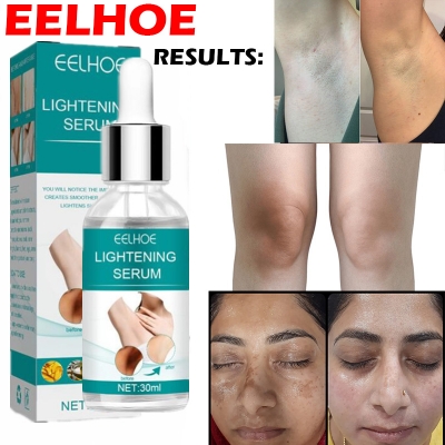 Picture of Retinol EELHOE Dark Parts Dark Underarm and Bikini Areas Whitening Anti Wrinkle Moisturizing Makes Your Private area Clean And White