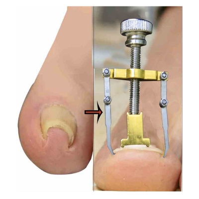 Picture of Nail care machine for nail repair