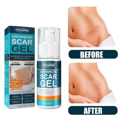 Picture of Jaysuing Advanced 50ml Scar Removal Gel - Effective Stretch Mark, Acnes Spots, Burns and Surgical Scars Treatment Cream Scar Gel No Side Effect