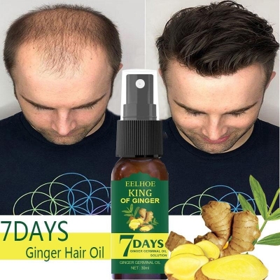 Picture of Rosemary Hair Growth Oil Ginger Anti Hair Loss Products Boost Hair Growing Serum Prevent Dry Frizz Damaged Scalp Repair Care