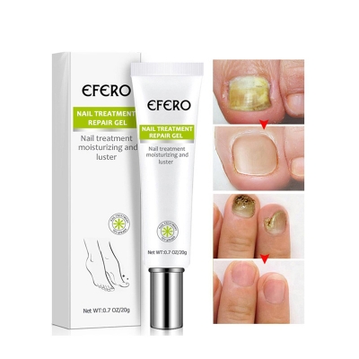 Picture of Efero Nail Repair Treatment Gel Fungus Cream-20gm