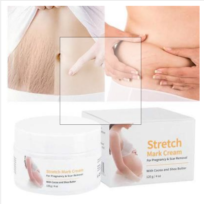 Picture of Melao Stretch Mark Cream 120gm For Pregnancy And Scar Removal Treatment With Cocoa And Shea Butter Belly Moisturizer