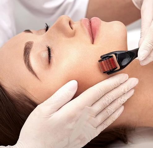 Picture of 540 Titanium Microneedle Derma Roller 0.5mm: For Hair Growth, Acne, Wrinkle, and Scar Treatment