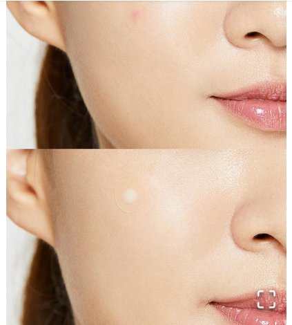 Picture of Cosrx Acne Pimple Master Patch 24 patches