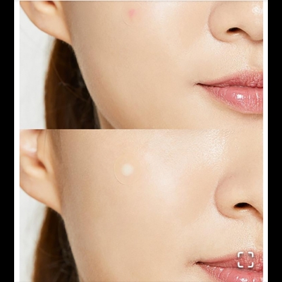 Picture of Cosrx Acne Pimple Master Patch 24 patches
