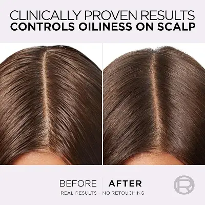 Picture of International Egypt Product Hare Care Loreal Elvive Hayaluron Pure 72hours Purifying Shampoo Used For Male /Female -400 Ml