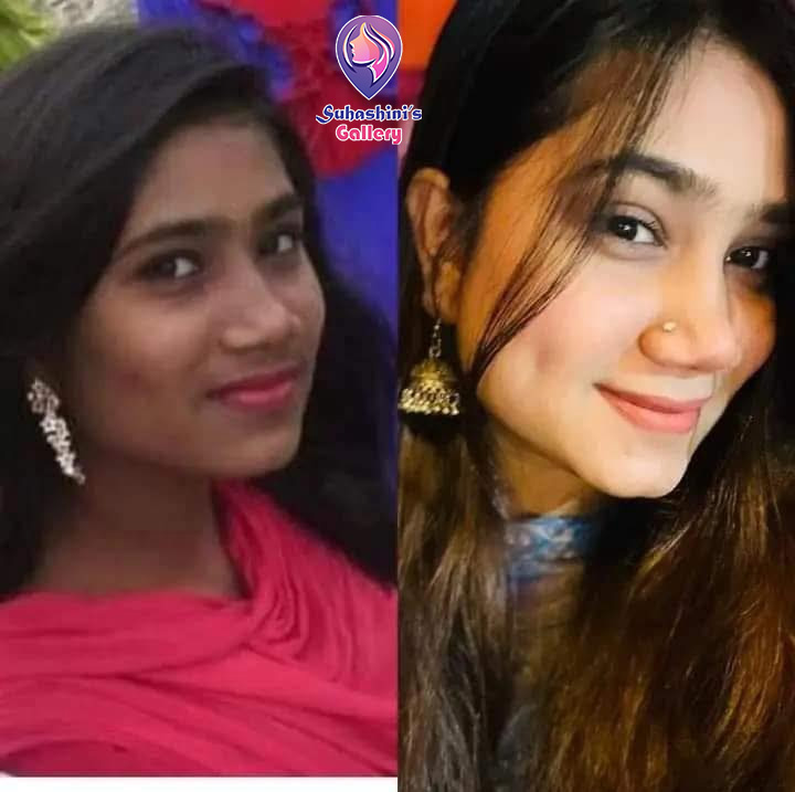 Picture of Natural Glow Combo - Kem Cot Thai Cream | Thanaka Face Pack | Tomato Soothing Gel WIth Free Lip Care