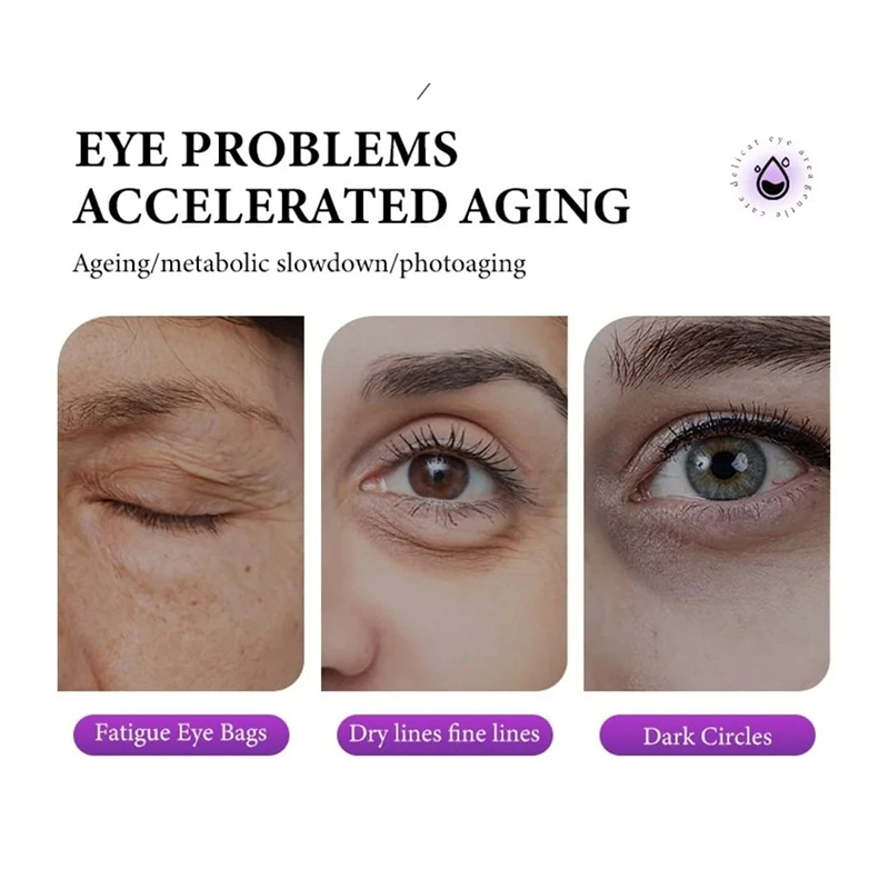 Picture of MOIKA Pro-Xylane Anti Wrinkle Aging Dark Circle Removal Eye Cream 15 Gm