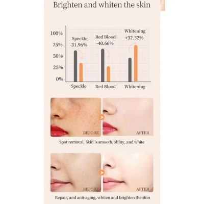 Picture of MOIKA  NEUROCOOLAMINE 10% + NAG  8% Whitening Freckle Removing Face Serum 30ml