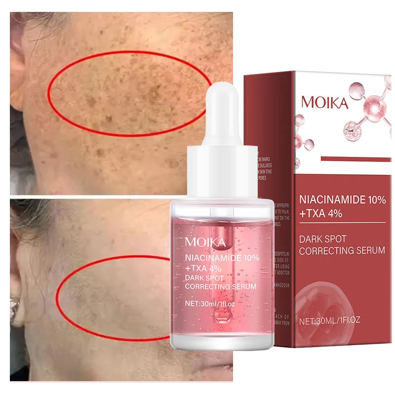 Picture of MOIKA 10% Niacinamide + 4% TXA Dark Spot Correcting Face Serum 30ml