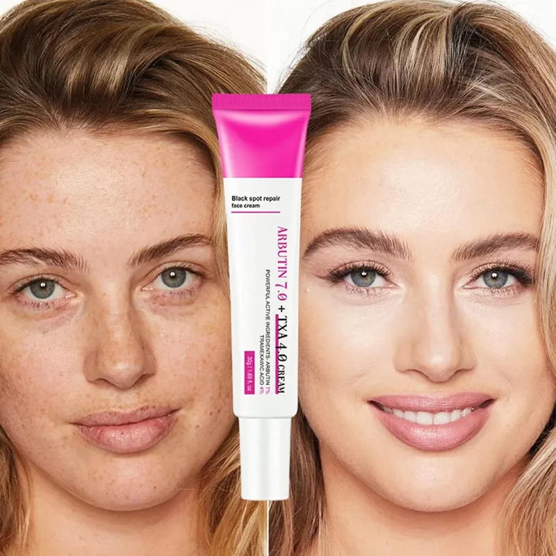 Picture of DOLANJN ARBUTIN 7.0 + TXA 4.0 Black Spot Correction and Repair Facial Cream 30Gm
