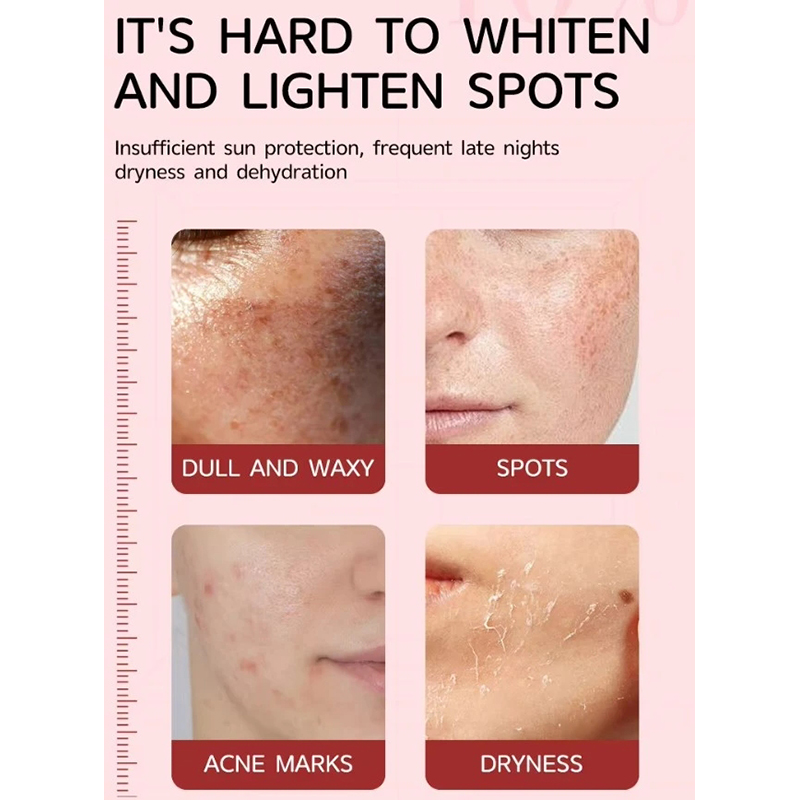 Picture of MOIKA 10% Niacinamide + 4% TXA Dark Spot Correcting Face Serum 30ml